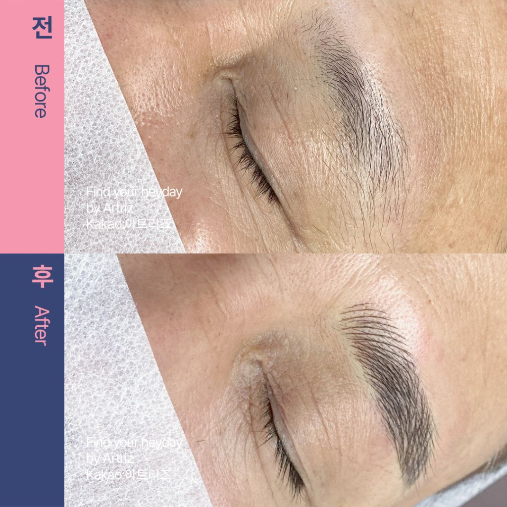눈썹문신 before after