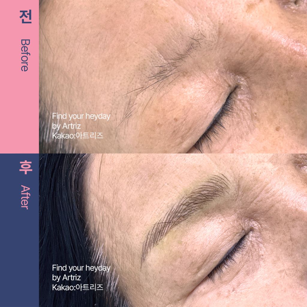 눈썹문신 before after