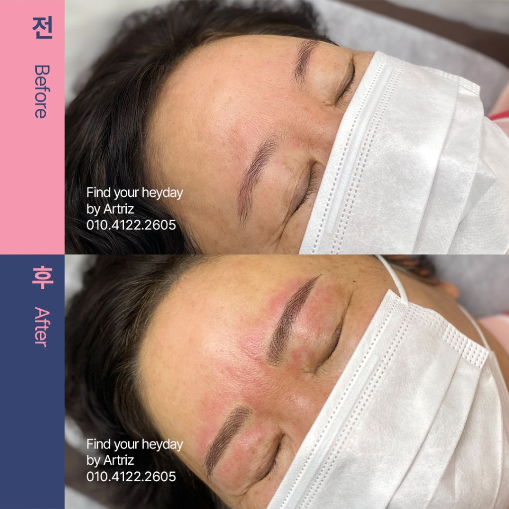 눈썹문신 before after