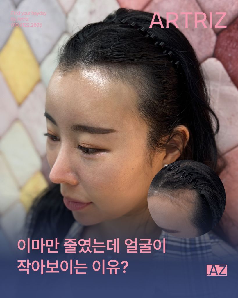 아트리즈 방문 고객