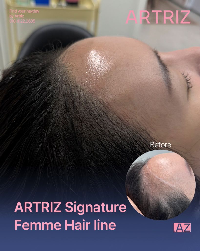 아트리즈 방문 고객