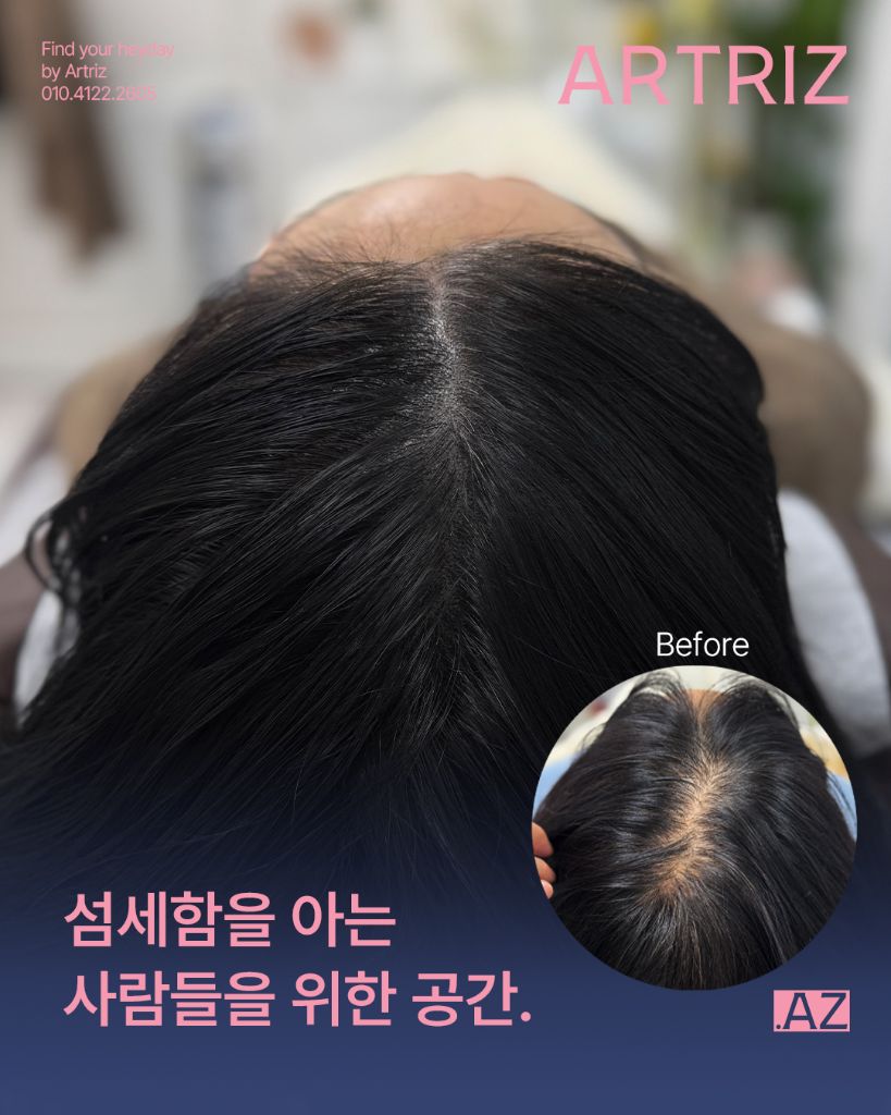 아트리즈 방문 고객