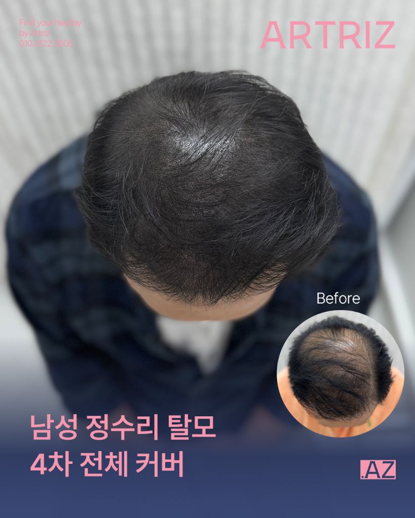 아트리즈 방문 고객