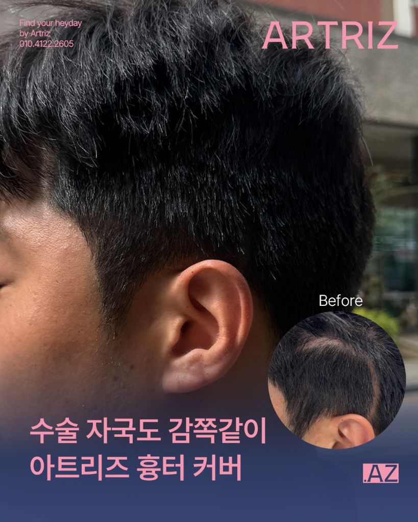 아트리즈 방문 고객